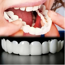 Знімні вініри Smile Veneers на дві щелепи, білі накладки на зуби для ідеальної усмішки, безпечні