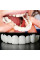 Знімні вініри Smile Veneers на дві щелепи, білі накладки на зуби для ідеальної усмішки, безпечні