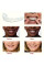 Знімні вініри Smile Veneers на дві щелепи, білі накладки на зуби для ідеальної усмішки, безпечні